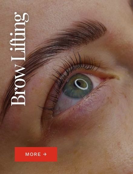 Brow Lifting